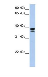 Fetal muscle lysate. Antibody concentration: 1.0 ug/ml. Gel concentration: 12%.