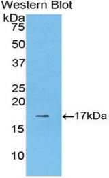 Western blot of recombinant LGALS9B.