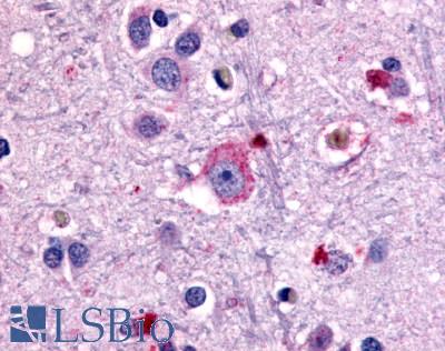 Anti-GRM1 / MGLUR1 antibody LS-A879 IHC of human brain, neurons and glia. Immunohistochemistry of formalin-fixed, paraffin-embedded tissue after heat-induced antigen retrieval.