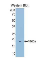 Western blot of recombinant LGALS9B.