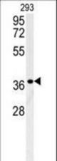 LGALS9B Antibody western blot of 293 cell line lysates (35 ug/lane). The LGALS9B antibody detected the LGALS9B protein (arrow).
