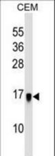 HSPC159 Antibody western blot of CEM cell line lysates (35 ug/lane). The HSPC159 antibody detected the HSPC159 protein (arrow).