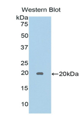 Western blot of recombinant LGALSL / Galectin 5.