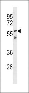 LGI3 Antibody western blot of MDA-MB231 cell line lysates (35 ug/lane). The LGI3 antibody detected the LGI3 protein (arrow).
