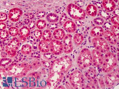 Anti-LGI3 antibody IHC of human kidney. Immunohistochemistry of formalin-fixed, paraffin-embedded tissue after heat-induced antigen retrieval. Antibody LS-B4972 concentration 5 ug/ml.