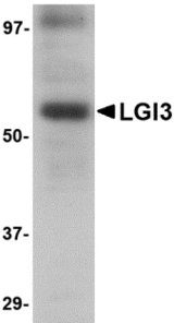 Western blot of LGI3 in human brain tissue lysate with LGI3 antibody at 1 ug/ml.
