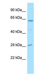 LGI4 antibody Western Blot of MCF7.