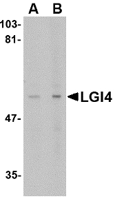 Western blot of LGI4 in rat brain tissue lysate with LGI4 antibody at (A) 1 and (B) 2 ug/ml.