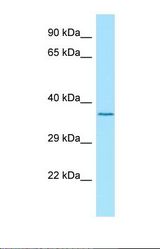 Western blot of Human Jurkat. LGI4 antibody dilution 1.0 ug/ml.