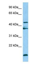 LGMN / Legumain antibody Western Blot of HepG2.