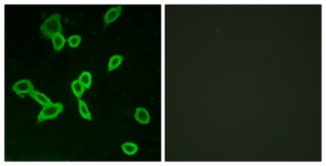 Immunofluorescence of LOVO cells, using LGR6 Antibody. The picture on the right is treated with the synthesized peptide.