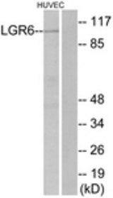 Western blot of extracts from HUVEC cells, using LGR6 Antibody. The lane on the right is treated with the synthesized peptide.