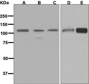 Western blot analysis on (A) human uterus, (B) human ovary, (C) HUVEC, (D) human adrenal gland, and (E) HeLa lysates using anti-LGR6 antibody.