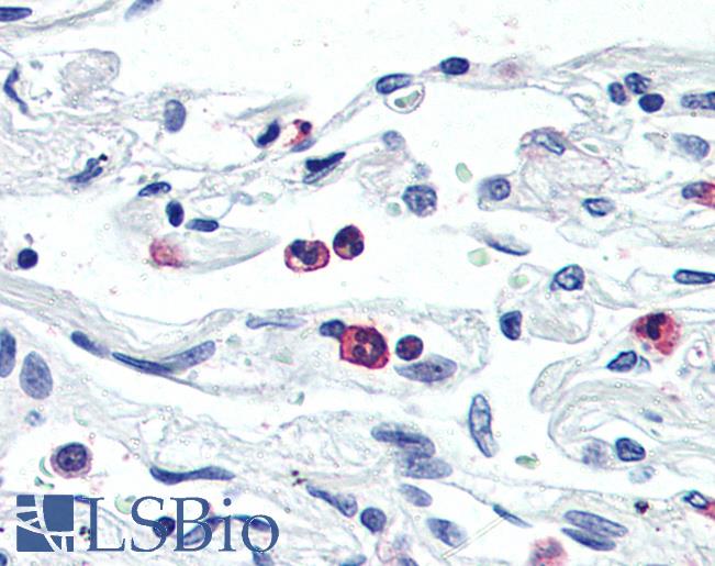 Anti-LGR6 antibody LS-A621 IHC of human neutrophils. Immunohistochemistry of formalin-fixed, paraffin-embedded tissue after heat-induced antigen retrieval.