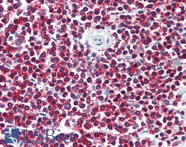 Anti-LGR6 antibody LS-A621 IHC of human spleen. Immunohistochemistry of formalin-fixed, paraffin-embedded tissue after heat-induced antigen retrieval.