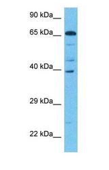Western blot of EIF2D Antibody with human Fetal Liver lysate.