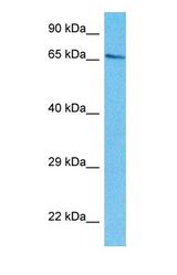 Western blot of EIF2D Antibody with human HepG2 Whole Cell lysate.