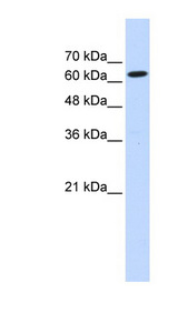EIF2D / LGTN antibody LS-C101865 Western blot of Transfected 293T cell lysate.