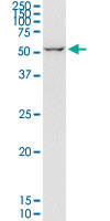 EIF2D monoclonal antibody (M05), clone 2D10. Western Blot analysis of EIF2D expression in MCF-7.