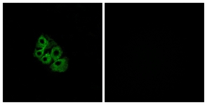 Immunofluorescence of A549 cells, using LSHR Antibody. The sample on the right was incubated with synthetic peptide.