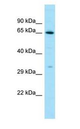 LHCGR / LHR / LH Receptor antibody Western Blot of THP-1. Antibody dilution: 1 ug/ml.