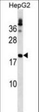 LHFP Antibody western blot of HepG2 cell line lysates (35 ug/lane). The LHFP antibody detected the LHFP protein (arrow).