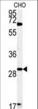 Western blot of LHPL2 Antibody in CHO cell line lysates (35 ug/lane). LHPL2 (arrow) was detected using the purified antibody.