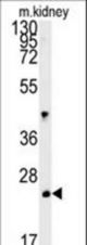 LHPL3 Antibody western blot of mouse kidney tissue lysates (15 ug/lane). The LHPL3 antibody detected the LHPL3 protein (arrow).