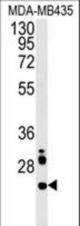 LHPL3 Antibody western blot of MDA-MB435 cell line lysates (15 ug/lane). The LHPL3 antibody detected the LHPL3 protein (arrow).