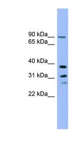 LHPP antibody LS-C116706 Western blot of A549 cell lysate.