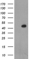 HEK293T cells were transfected with the pCMV6-ENTRY control (Left lane) or pCMV6-ENTRY LHX1 (Right lane) cDNA for 48 hrs and lysed. Equivalent amounts of cell lysates (5 ug per lane) were separated by SDS-PAGE and immunoblotted with anti-LHX1.