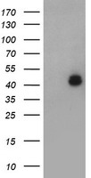 HEK293T cells were transfected with the pCMV6-ENTRY control (Left lane) or pCMV6-ENTRY LHX1 (Right lane) cDNA for 48 hrs and lysed. Equivalent amounts of cell lysates (5 ug per lane) were separated by SDS-PAGE and immunoblotted with anti-LHX1.