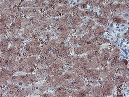 IHC of paraffin-embedded Human liver tissue using anti-LHX1 mouse monoclonal antibody. (Heat-induced epitope retrieval by 10mM citric buffer, pH6.0, 100C for 10min).