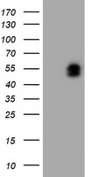 HEK293T cells were transfected with the pCMV6-ENTRY control (Left lane) or pCMV6-ENTRY LHX1 (Right lane) cDNA for 48 hrs and lysed. Equivalent amounts of cell lysates (5 ug per lane) were separated by SDS-PAGE and immunoblotted with anti-LHX1.