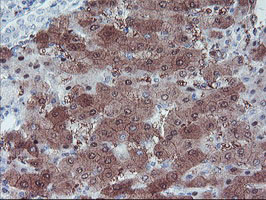 IHC of paraffin-embedded Human liver tissue using anti-LHX1 mouse monoclonal antibody.