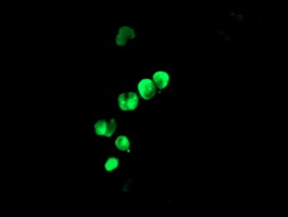 Anti-LHX1 mouse monoclonal antibody immunofluorescent staining of COS7 cells transiently transfected by pCMV6-ENTRY LHX1.