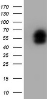 HEK293T cells were transfected with the pCMV6-ENTRY control (Left lane) or pCMV6-ENTRY LHX1 (Right lane) cDNA for 48 hrs and lysed. Equivalent amounts of cell lysates (5 ug per lane) were separated by SDS-PAGE and immunoblotted with anti-LHX1.