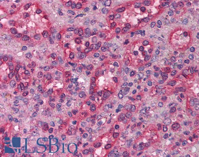 Anti-LHX1 antibody IHC of human spleen. Immunohistochemistry of formalin-fixed, paraffin-embedded tissue after heat-induced antigen retrieval. Antibody LS-B1574 concentration 5 ug/ml.