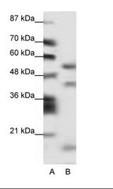 A: Marker, B: HepG2 Cell Lysate