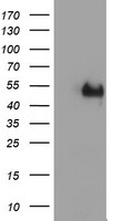 HEK293T cells were transfected with the pCMV6-ENTRY control (Left lane) or pCMV6-ENTRY LHX1 (Right lane) cDNA for 48 hrs and lysed. Equivalent amounts of cell lysates (5 ug per lane) were separated by SDS-PAGE and immunoblotted with anti-LHX1.