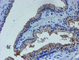 IHC of paraffin-embedded Human prostate tissue using anti-LHX1 mouse monoclonal antibody. (Heat-induced epitope retrieval by 10mM citric buffer, pH6.0, 100C for 10min).