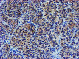 IHC of paraffin-embedded Human pancreas tissue using anti-LHX1 mouse monoclonal antibody. (Heat-induced epitope retrieval by 10mM citric buffer, pH6.0, 100C for 10min).