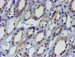 IHC of paraffin-embedded Human Kidney tissue using anti-LHX1 mouse monoclonal antibody. (Heat-induced epitope retrieval by 10mM citric buffer, pH6.0, 100C for 10min).