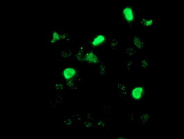 Anti-LHX1 mouse monoclonal antibody immunofluorescent staining of COS7 cells transiently transfected by pCMV6-ENTRY LHX1.