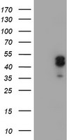 HEK293T cells were transfected with the pCMV6-ENTRY control (Left lane) or pCMV6-ENTRY LHX1 (Right lane) cDNA for 48 hrs and lysed. Equivalent amounts of cell lysates (5 ug per lane) were separated by SDS-PAGE and immunoblotted with anti-LHX1.