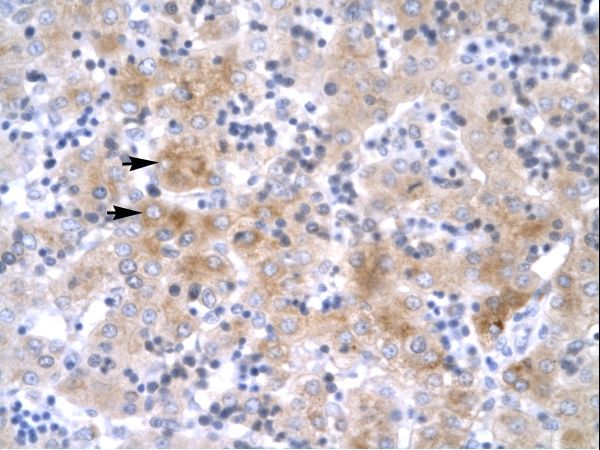 LHX1 antibody LS-C30968 was used in IHC to stain formalin-fixed, paraffin-embedded human liver.