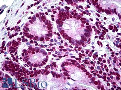 Anti-LHX1 antibody IHC of human small intestine. Immunohistochemistry of formalin-fixed, paraffin-embedded tissue after heat-induced antigen retrieval. Antibody LS-B5429 concentration 5 ug/ml.