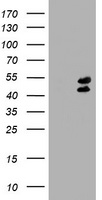 HEK293T cells were transfected with the pCMV6-ENTRY control (Left lane) or pCMV6-ENTRY LHX1 (Right lane) cDNA for 48 hrs and lysed. Equivalent amounts of cell lysates (5 ug per lane) were separated by SDS-PAGE and immunoblotted with anti-LHX1.