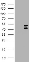 HEK293T cells were transfected with the pCMV6-ENTRY control (Left lane) or pCMV6-ENTRY LHX1 (Right lane) cDNA for 48 hrs and lysed. Equivalent amounts of cell lysates (5 ug per lane) were separated by SDS-PAGE and immunoblotted with anti-LHX1.