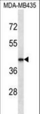 LHX2 Antibody western blot of MDA-MB435 cell line lysates (35 ug/lane). The LHX2 antibody detected the LHX2 protein (arrow).
